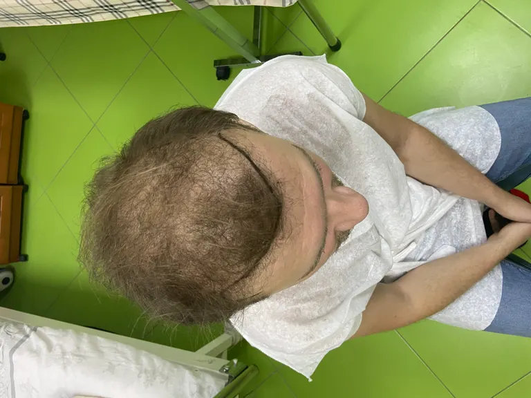 До операции